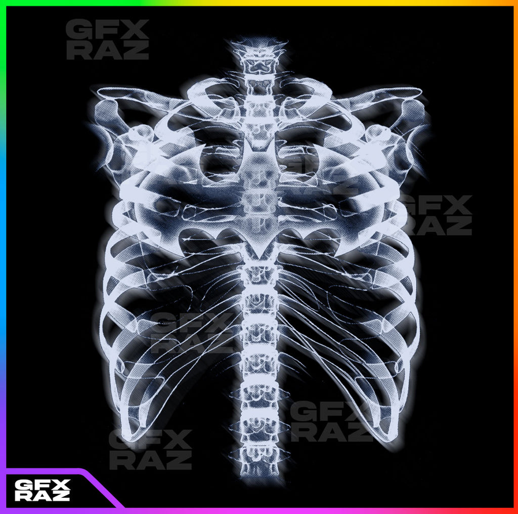 XRAY RIBCAGE - PREMADE