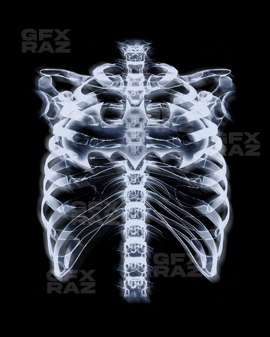 XRAY RIBCAGE - PREMADE